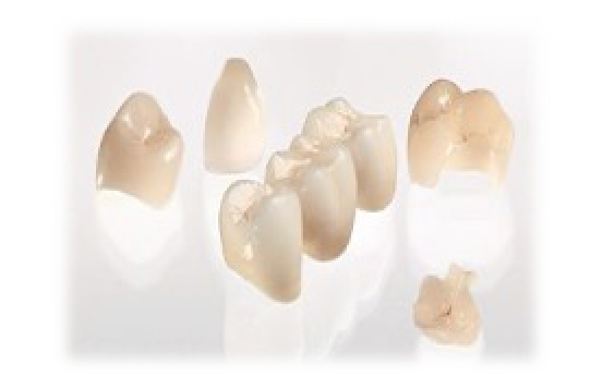 1DAYセラミック治療で製作する流れ③